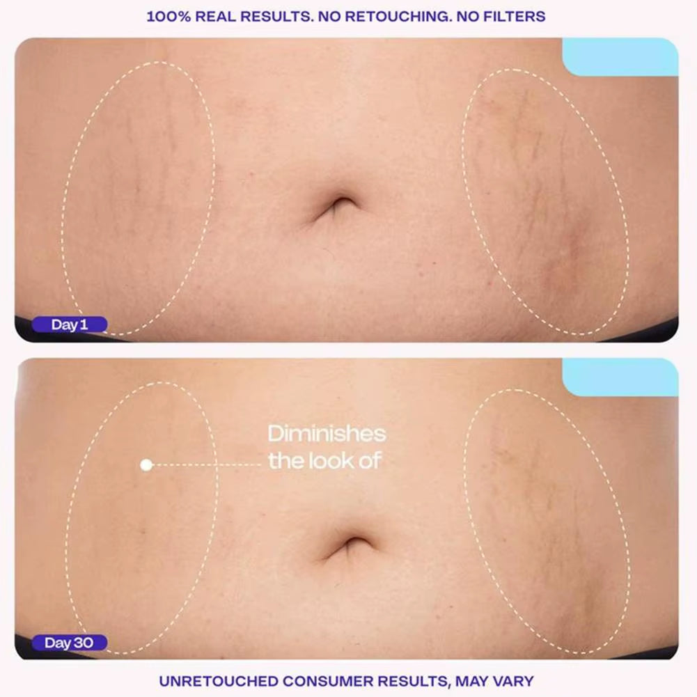 BARUBT Belly Firming Cream Lifts Firms and Smoothes Sagging Skin Minimizing Postpartum or Aging-Related Abdominal Wrinkles